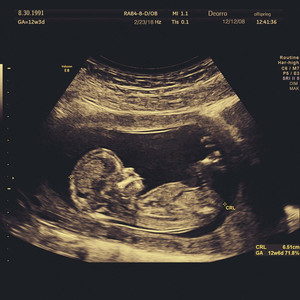 俄罗斯女人和狗交配
